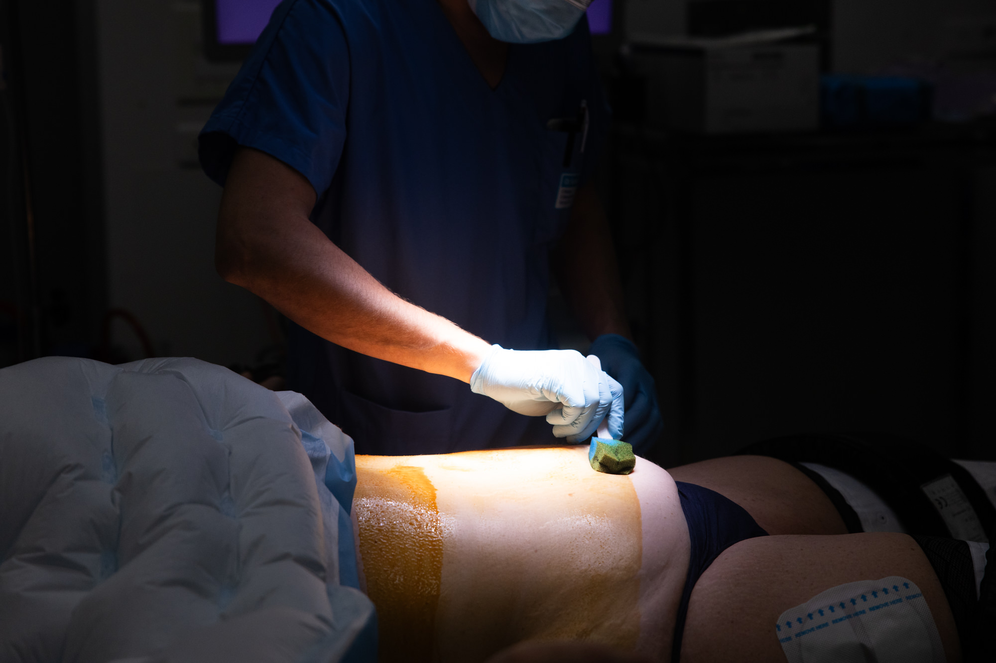 Reportage photo médical sur chirurgie bariatrique à Montpellier 